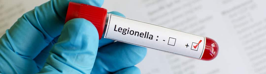 Legionella testing for safety shower water filter blog post